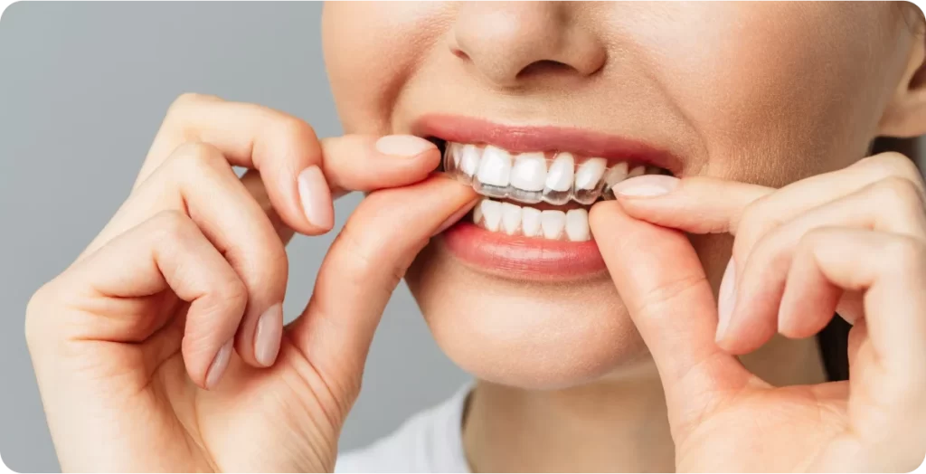 SOLUCOES ORTODONTICAS